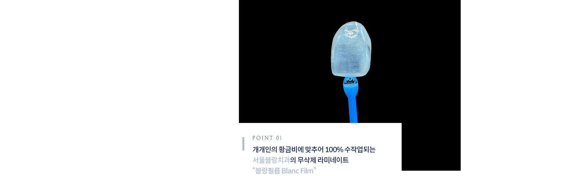 서울블랑치과의 무삭제 라미네이트