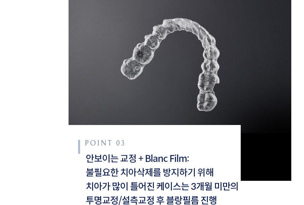안보이는 교정 + Blanc Film