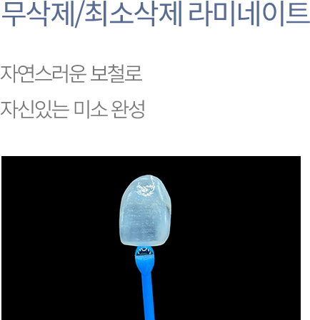 무삭제/최소삭제 라미네이트