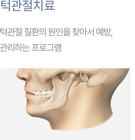 턱관절치료