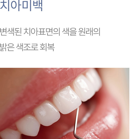 치아미백