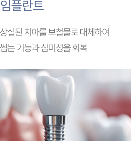 임플란트