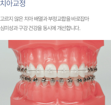 치아교정