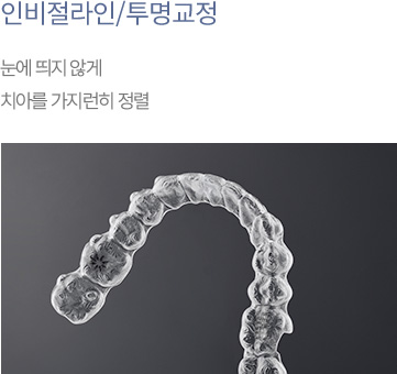 인비절라인/투명교정