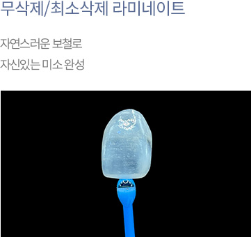 무삭제/최소삭제 라미네이트