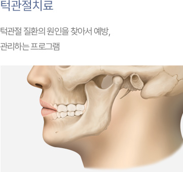 턱관절치료