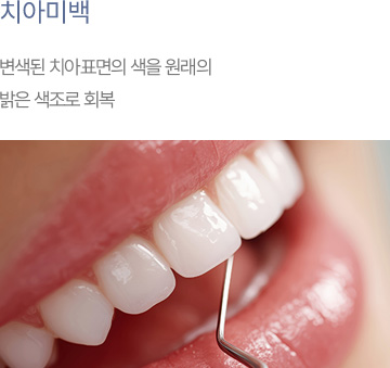 치아미백