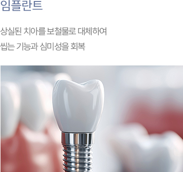 임플란트